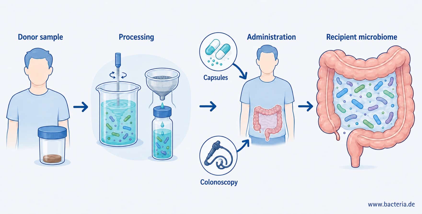 How does a fecal microbiota transplant (FMT) work?